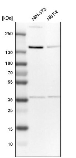 Tripeptidyl peptidase II Antibody, Novus Biologicals:Antibodies:Primary